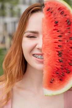 Beautiful red-haired woman smiling with braces on her teeth covers half of her face with a slice of watermelon outdoors in summer.