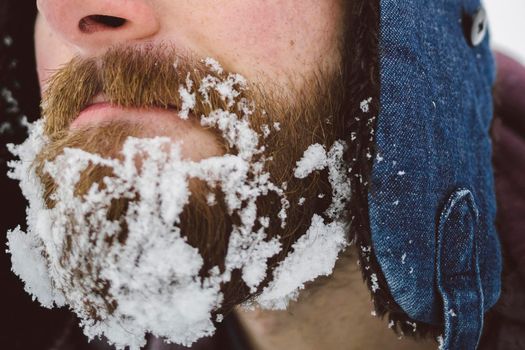 Frozen snow on the beard.