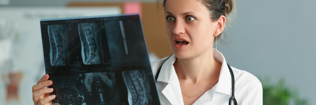 Portrait of surprised woman professional doctor with patient result on x ray. Shocked expression on medical worker face, unexpected result. Medicine concept