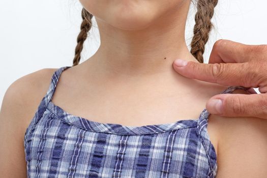 Adult finger showing birthmark on child neck on white background