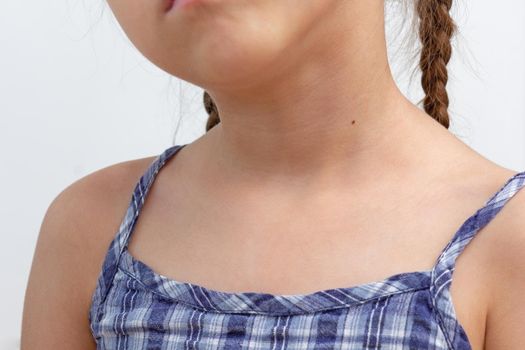 Cropped child neck with birthmark on white background