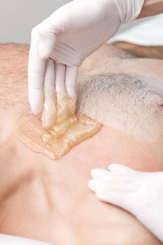 Epilation chest of young male with liquid wax paste by hands of female cosmetologist in beauty salon