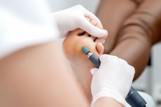 Peeling feet pedicure procedure from callus on foot by hands of podiatrist in white gloves at beauty salon