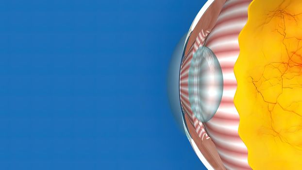 Low-tension or normal-pressure glaucoma. In normal-tension glaucoma the optic nerve is damaged even though the pressure in the eye is not very high. 3d illustration