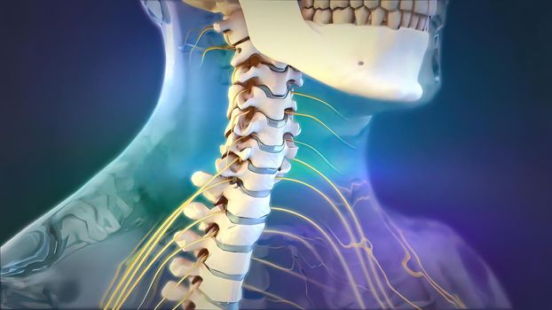 of the effects of arthritis on a healthy lumbar spine. 3d illustration