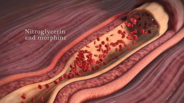 Nicotine raises blood pressure 3d illustration