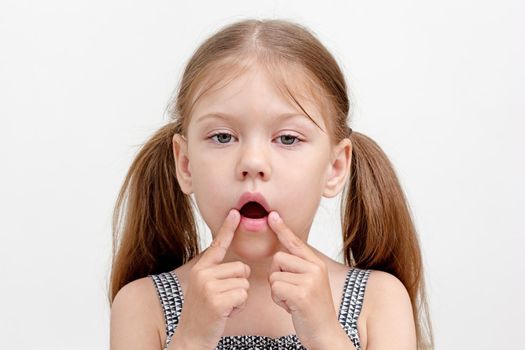 Caucasian little girl of 6 years with open mouth and fingers on mouth corner. To show impaired articulatory motility and muscle tone as form of dysarthria.