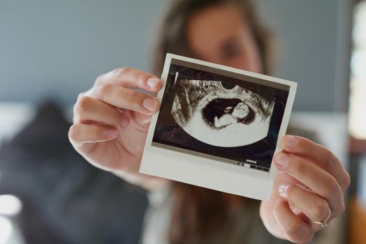 Shot of a woman holding a sonogram of her unborn baby.