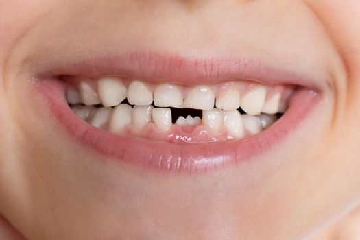 Milk teeth and first molar growing