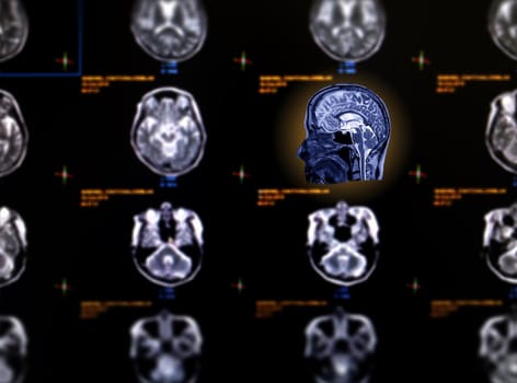 Selective focus of MRI brain sagittal view on blurred mri brain axial background.