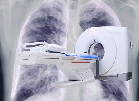 multi detector CT Scanner ( Computed Tomography ) on chest x-ray background for diagnosis covid - 19.