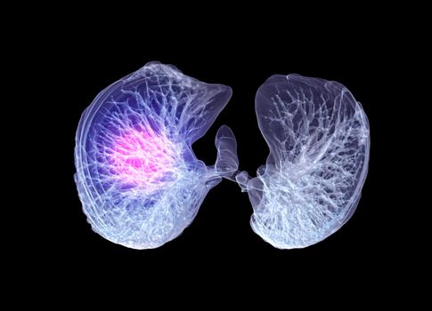 CT Chest or Lung 3D rendering image buttom view for diagnosis TB,tuberculosis and covid-19 .