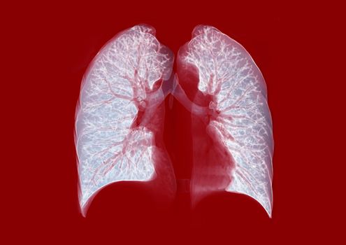 CT Chest or Lung 3D rendering image on red background for diagnosis TB,tuberculosis and covid-19 .
