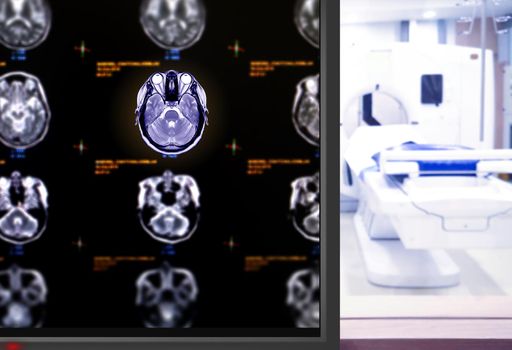 MRI Brain axial plane on the mornitor in MRI Scanner room at the hospital.