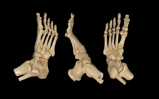 CT Scan of Right Foot 3D rendering image AP , Lateral and bottom view .medical technology concept.