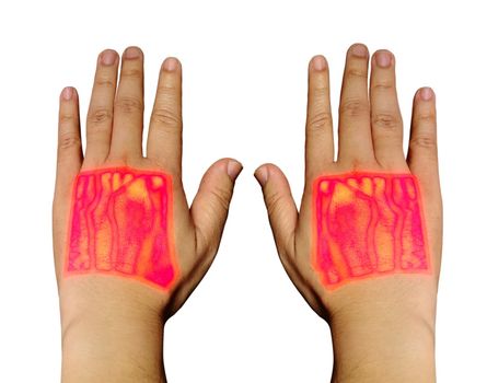Vein finder handheld infrared of Both hand showing cephalic vein and basilic vein for blood sample test