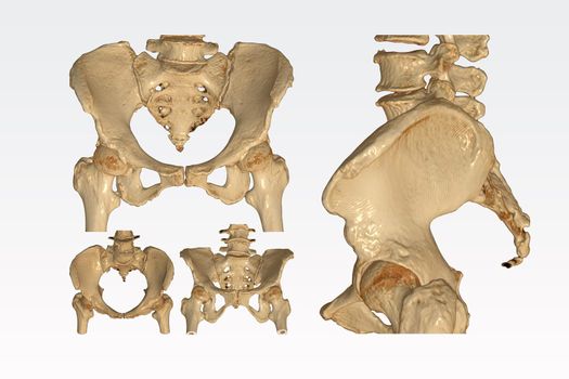 Collection of CT Scan pelvic bone with both hip joint 3D rendering image isolated on white background. Clipping path.