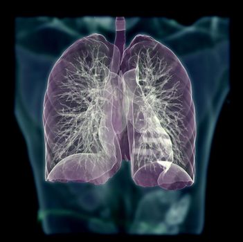 CT Chest or Lung 3D rendering image on blurred human body background for diagnosis TB,tuberculosis and covid-19 .