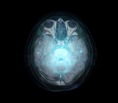 transparent image of the Skull AP Blue color with Brain for medical background concept.