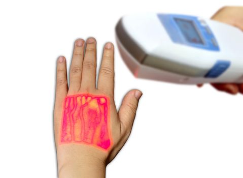 Vein finder handheld infrared of left hand showing cephalic vein and basilic vein for blood sample test