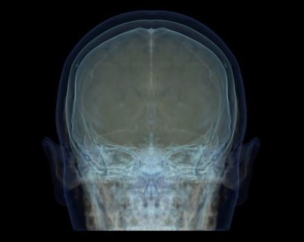 transparent image of the Skull Blue color for medical background concept.