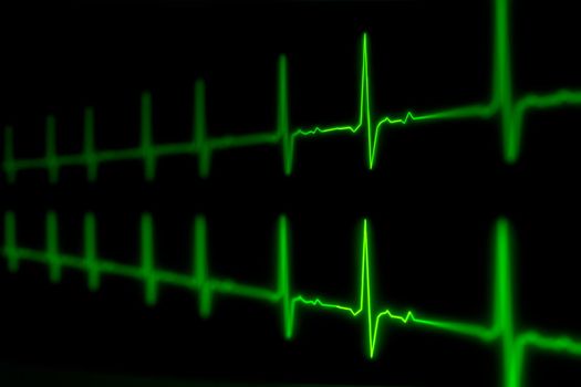 ECG or EKG pulse heartbeat of life sign green line 3D illustration.