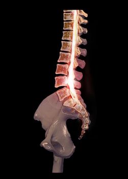 CT Lumbar spine or L-S spine 3D rendering image sagittal view 3D rendering .