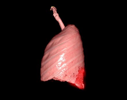 3d renderings of human lung lateral view showing respiratory system infection.