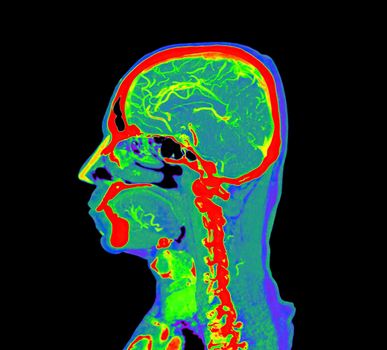 colorful of CT angiography of the brain or CTA brain Sagittal view . Clipping path.