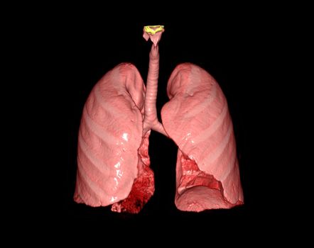 3d renderings of human lung showing respiratory system.