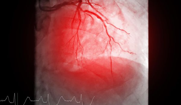 Cardiac catheterization is a test used to find out cardiac arrest .