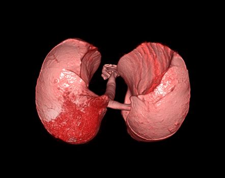3d renderings of human lung showing respiratory system.