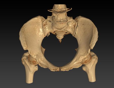 CT Scan of pelvic bone with both hip joint 3D rendering image Inlet view isolated on black background. Clipping path.
