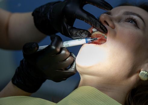 The process of removing braces.Beautiful woman in dental chair during procedure of installing braces to upper and lower teeth. Dentist and assistant working together, dental tools in their hands.