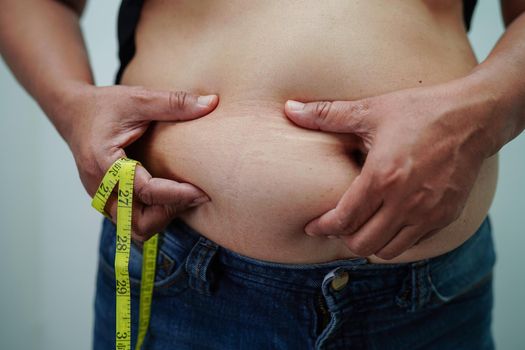 Overweight asian woman use hand to squeeze fat belly big size overweight and obesity.