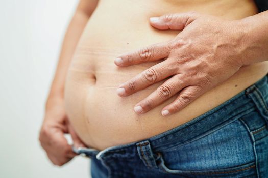 Asian woman show fat belly big size overweight and obesity at office.
