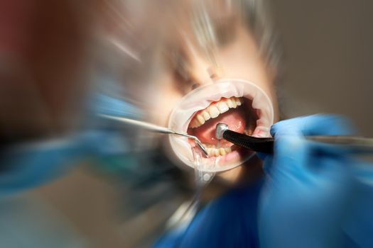 Lady patient sitting in stomatology chair, dentist drilling tooth, modern clinic