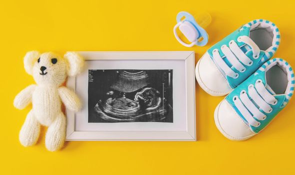 Ultrasound picture of a baby's photograph and accessories. Selective focus. child.