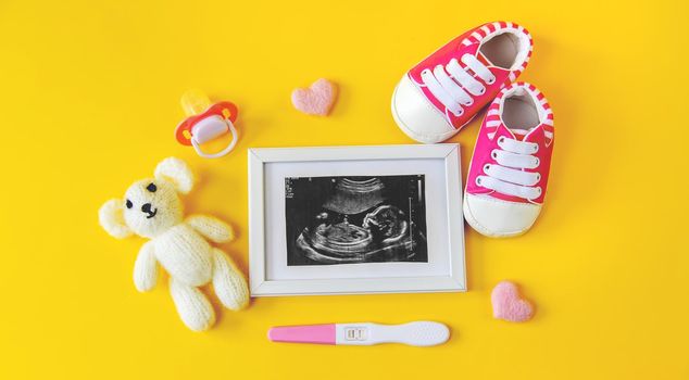 Ultrasound picture of a baby's photograph and accessories. Selective focus. child.