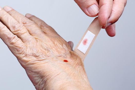 Nurse pulling adhesive bandage off elderly woman hand