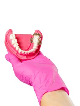 Dentist's hand in a latex glove with the layout of the human jaw on the white isolated background.