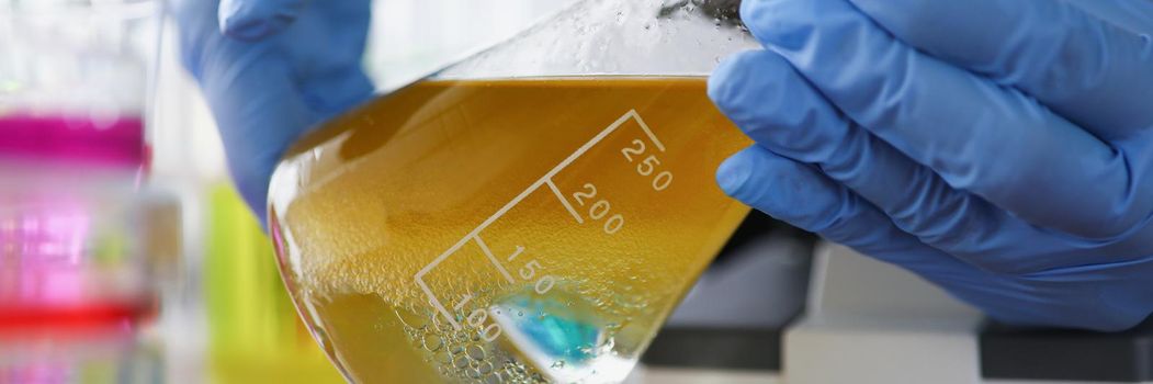 Close-up of scientist in protective gloves holding flask with yellow liquid in medical chemistry lab. Chemist doing experiment in laboratory. Science, discovery, test concept