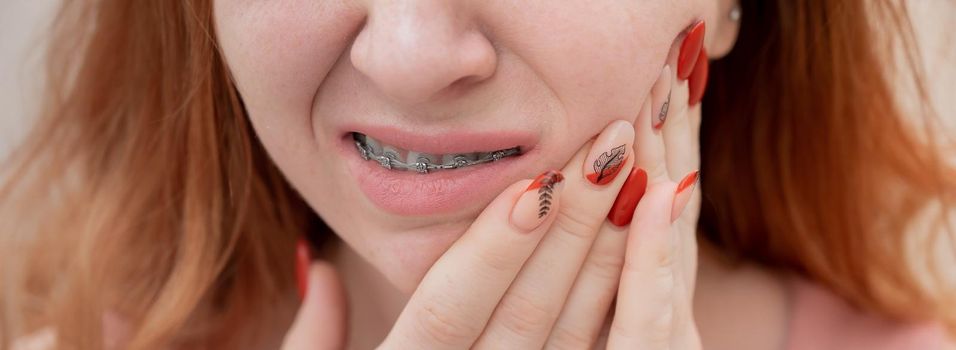 Young red-haired woman with braces suffering from pain