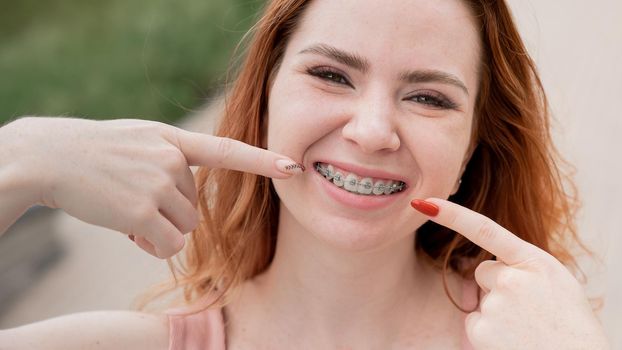 Young red-haired woman with braces on her teeth point to a smile outdoors in summer.