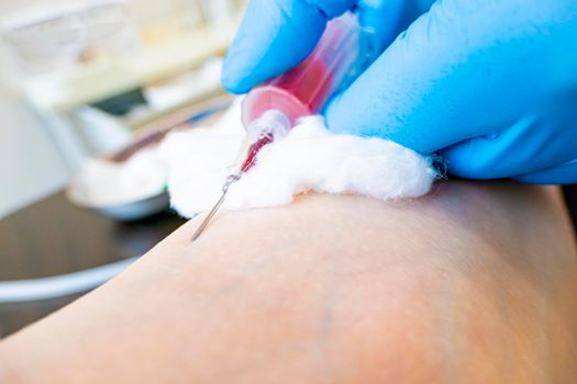 Close up nurse pricking needle syringe in the arm patient drawing blood sample for blood test
