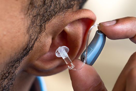 Close-up of the placement of the prosthesis in the ear of a young man.