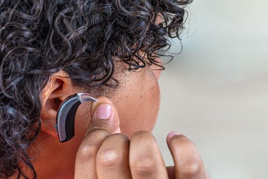 Close-up of a prosthesis being installed on a teenager.