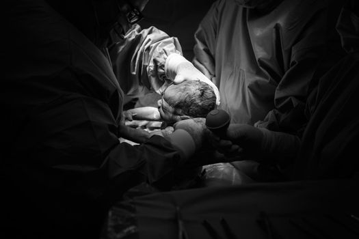 Cesarean section. The operation is in process. The child closeup