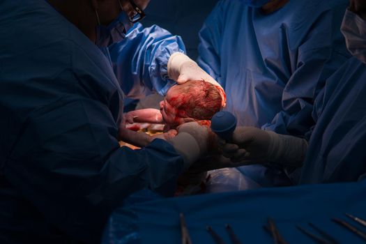 Cesarean section. The operation is in process. The child closeup