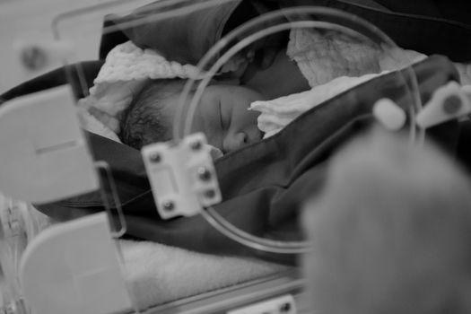 Newborn in the first few minutes of life in a hospital room.